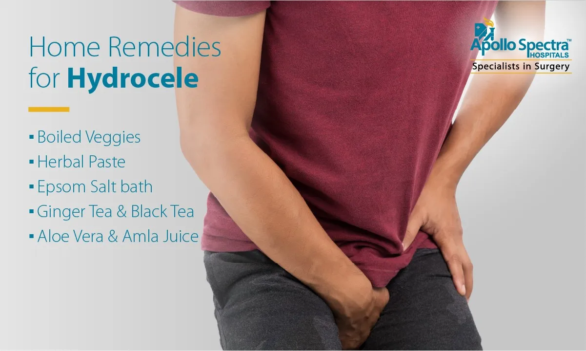 Top 10 Home Remedies for Hydrocele